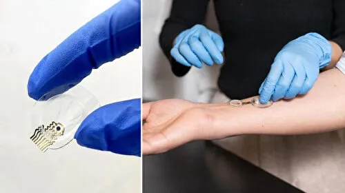 Akıllı Bandaj iCares: Enfeksiyonu Günler Öncesinden Yakala!